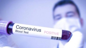 Dinkes Pastikan Bojonegoro Aman dari Virus Corona