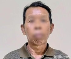 Kakek Perangkat Desa di Bondowoso, Cabuli Anak SD hingga Hamil