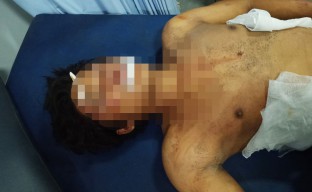 Warga Prambon Sidoarjo Hajar Dua Penjambret Apes