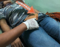Depresi Usai Alami Kecelakaan, Pria Asal Driyorejo Gresik Ini Gantung Diri