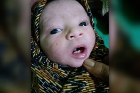 Cisss...Baru Lahir Sudah Tumbuh Gigi, Warga Probolinggo Dibuat Heboh
