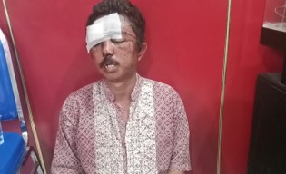 Kepergok Warga Curi Motor, Agung Kabur ke Rumah Sakit Lalu ke Polsek Kenjeran