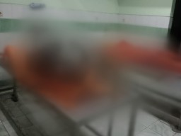 Lima Orang Tewas Dua Luka Berat Akibat Ledakan Tangki Metanol PT CAS di Gresik