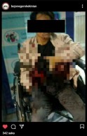 Seorang Pemuda Ditusuk Orang Tak Dikenal di Taman Talun Bojonegoro