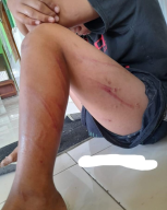 Dua Bocah Penghuni Panti Asuhan di Benjeng Gresik Babak Belur Disabet Kabel Tembaga oleh Anak Pengelola