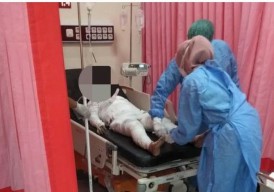 Pria di Probolinggo Bakar Istri dan Anak Tiri