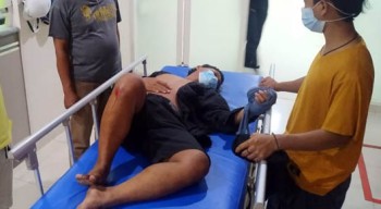 Senggolan Motor, Tidak Terima Lalu Bacok Tetangga
