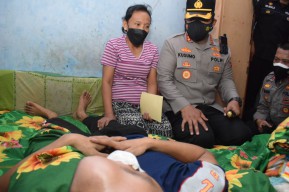 Kapolresta Sidoarjo Kunjungi Penderita Tumor Mata, Beri Batuan dan Upayakan Pengobatan