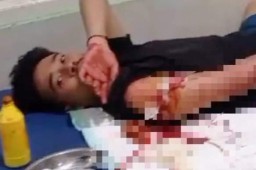 Pelaku Pembacokan di Jalan Pangsud Gresik Masih Bocil, Motifnya Bikin Kaget