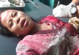 Perempuan di Jember Diduga Dibacok Kepala Dusun, Suami Rekam Video Kejadian