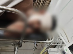 Diduga Hendak Curi Motor di Gresik, Dua Pemuda Asal Sumba Dihajar Massa hingga Babak Belur