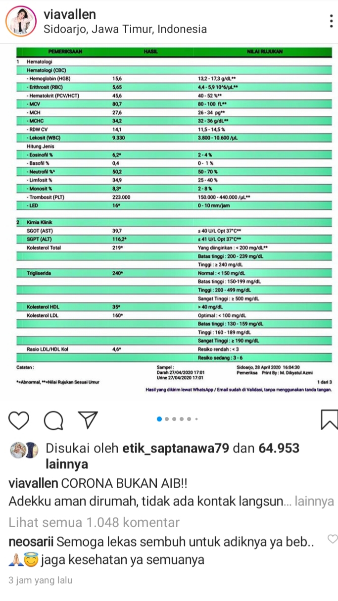 Adik Pedangdut Via Vallen Positif Covid-19