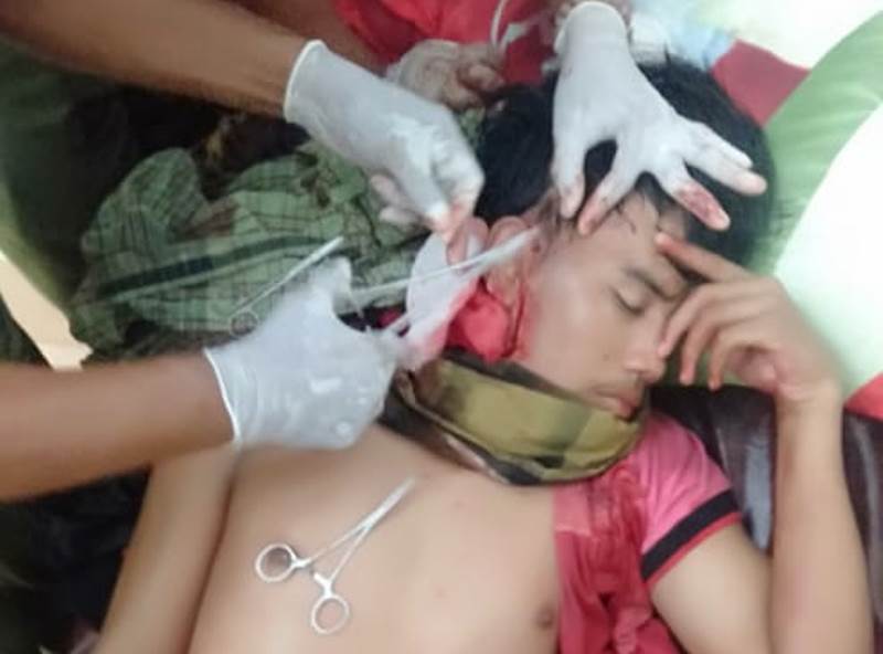 Ngopi Nginjak Kaki, Pemuda Bawean Ini Dikeroyok Hingga Klenger