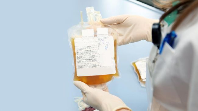 Ayo Ker..... Donor Darah Penyintas Covid Karena Stok Darah Plasma Konvalesen Malang Habis