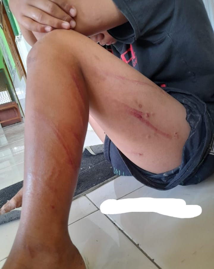 Dua Bocah Penghuni Panti Asuhan di Benjeng Gresik Babak Belur Disabet Kabel Tembaga oleh Anak Pengelola