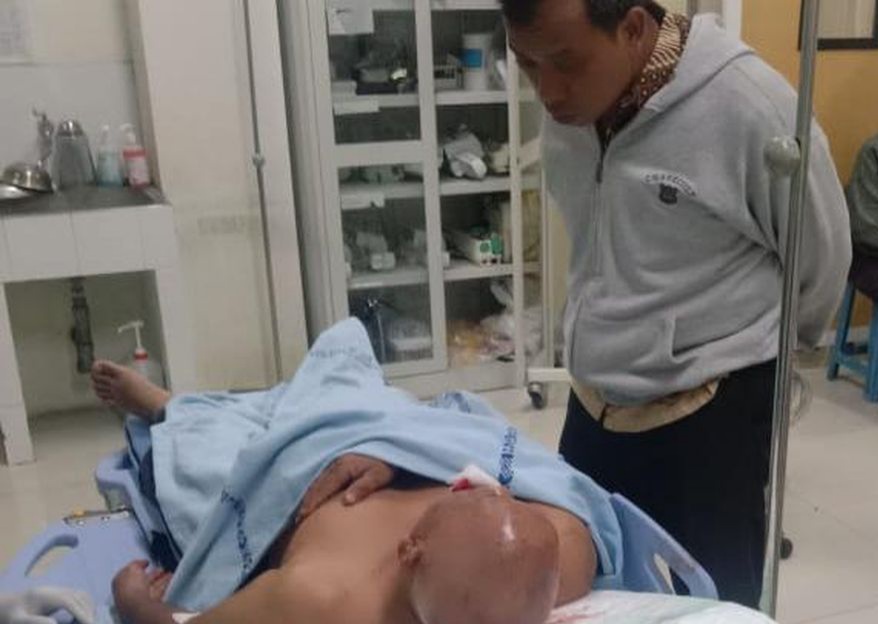 Driver Taksi Online di Surabaya Dibegal, Leher Dijerat Ikat Pinggang Lalu Dipukul Hingga Berlumuran Darah