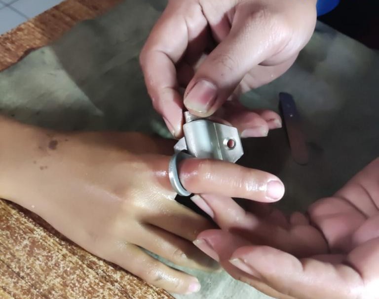 Jari Tangan Kejepit Lubang Engsel Pintu, Baim Diselamatkan Damkarla Gresik