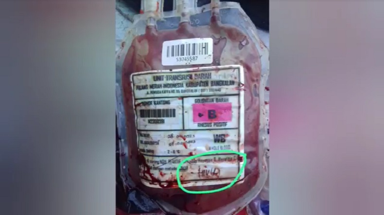 Puluhan Kantong Darah Bertuliskan HIV Berserakan di Sampah, PMI Bangkalan : Kami Teledor