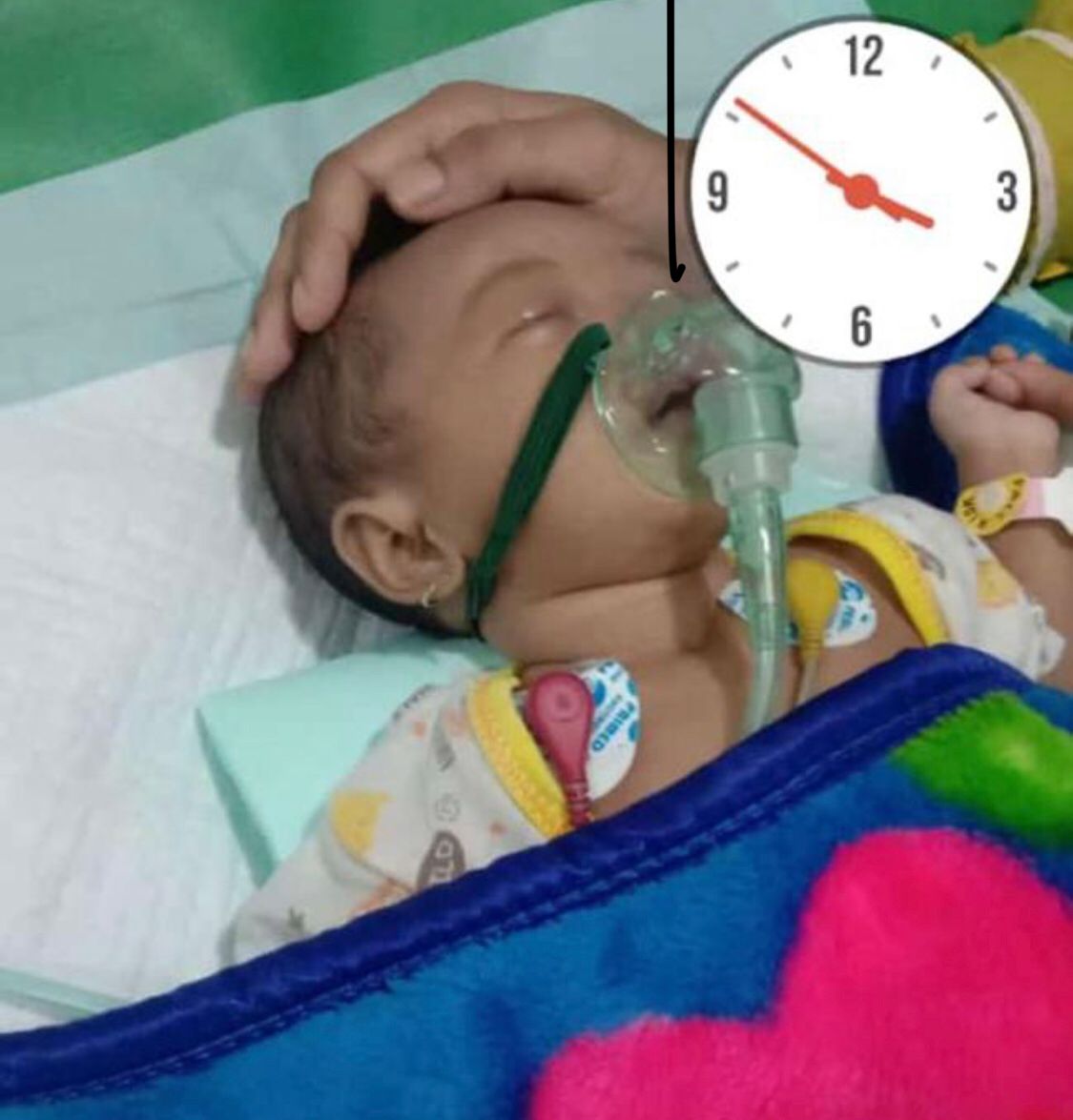 Keluarga Bayi di Gresik yang Meninggal Usai Dengar Petasan Lapor Polisi