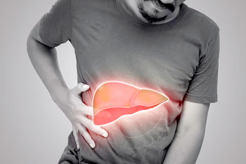 Jangan Tunggu Terkena Hepatitis, Kenali Gejala dan Pencegahannya